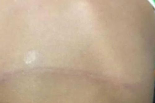 Kỷ luật giáo viên dùng dây điện đánh học sinh lớp 2 hằn lưng