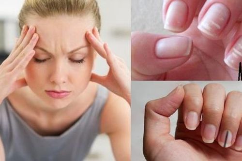 Cảnh báo những bệnh lý có thể phát hiện qua hình dáng móng tay
