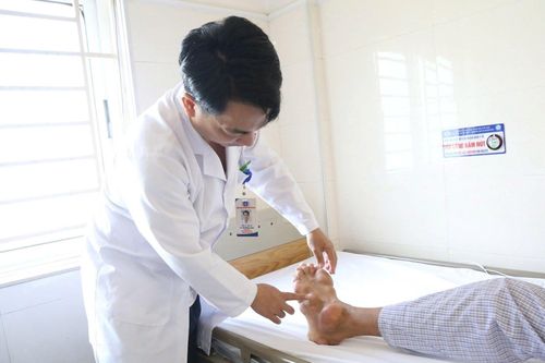Biến dạng tứ chi do bệnh gout