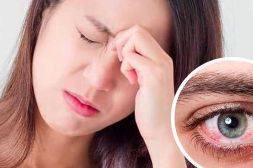 Chăm sóc mắt trong mùa bão lũ cần lưu ý gì?