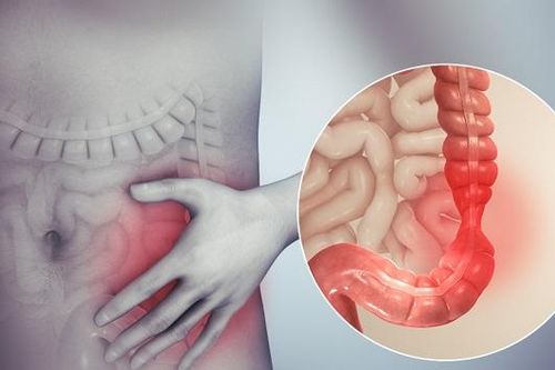 Dấu hiệu nhận biết bệnh viêm ruột