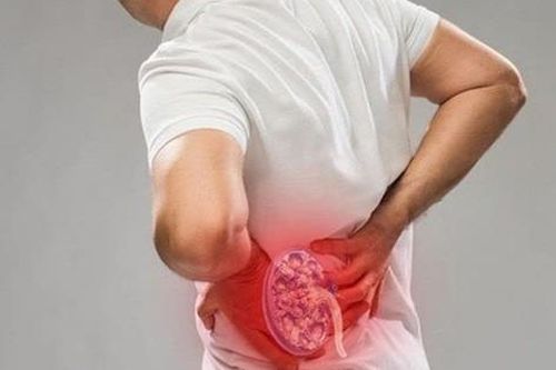 Câu hỏi thường gặp liên quan đến áp xe thận