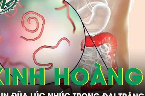 Kinh hoàng hàng chục con giun đũa dài hơn 10cm lúc nhúc trong đại tràng người đàn ông