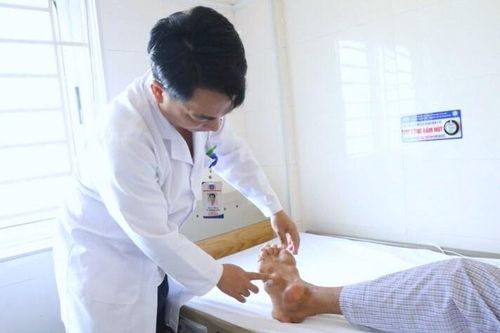Tứ chi biến dạng gây ám ảnh của người đàn ông mắc bệnh Gout