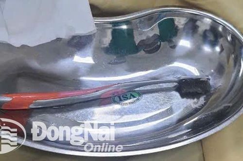 Hy hữu: Cô gái vô tình nuốt phải bàn chải đánh răng