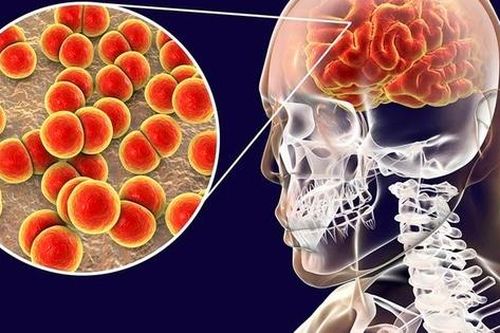 6 bệnh viêm màng não, viêm não thường gặp