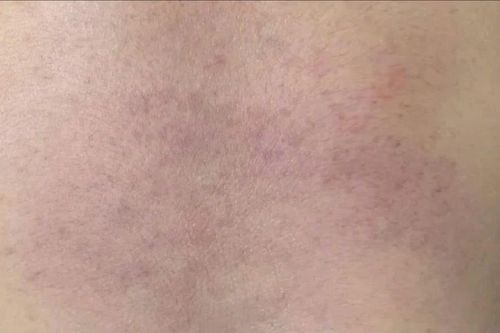 Bình Thuận: Điều tra vụ cháu bé nghi bị bạo hành tại nhóm trẻ tư thục