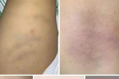 Tin mới vụ nghi bạo hành bé 1 tuổi tại nhà trẻ ở Bình Thuận