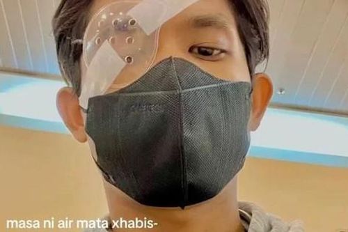 Nam thanh niên 21 tuổi hỏng giác mạc vì thói quen hàng triệu người mắc