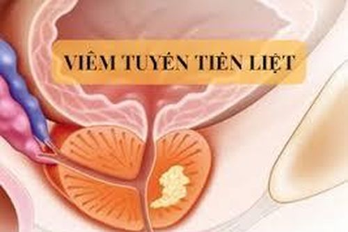 Viêm tuyến tiền liệt nhiễm khuẩn mạn tính có thể chữa khỏi hoàn toàn không?