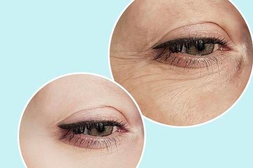 Thói quen cần loại bỏ để hạn chế nếp nhăn dưới mắt