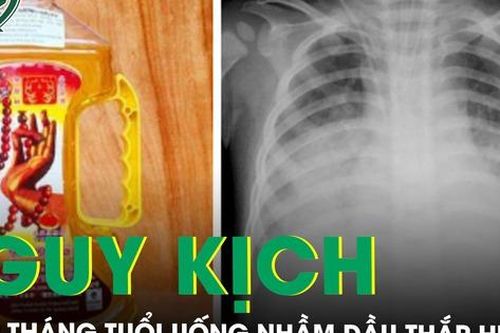 Trẻ 19 tháng tuổi nguy kịch khi uống nhầm dầu thắp hương