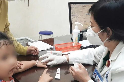 Đề phòng bệnh chốc lây lan ở trẻ