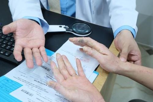 4 bệnh về da thường gặp mùa mưa bão, biết điều này có thể phòng tránh