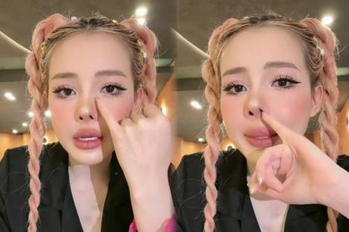 Ngân 98 đứng trước nguy cơ bị rút sụn mũi