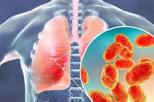 Viêm phổi do tụ cầu có biểu hiện như thế nào?