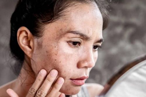 Vì sao uống collagen thường xuyên làn da vẫn không đẹp?