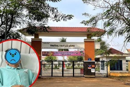 Nam sinh lớp 11 ở Bình Phước bị bạn đánh gãy răng, phải nhập viện cấp cứu