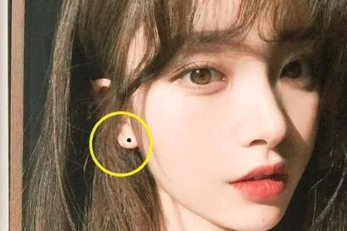 Top 10 nốt ruồi may mắn nhất trông như thế nào? Hãy xem bạn có được bao nhiêu?