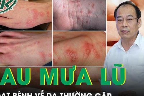 Loạt bệnh về da thường gặp sau mùa mưa lũ cần đặc biệt lưu ý
