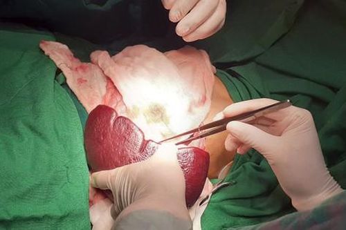 8 câu hỏi thường gặp liên quan đến bệnh cường lách