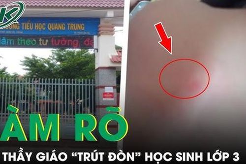 Lời trần tình của thầy giáo bị tố 'trút đòn' vào học sinh lớp 3