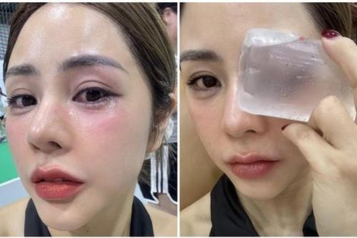 Vợ Huỳnh Anh gặp sự cố