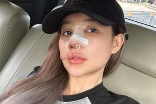 Nỗi sợ của Ngân 98 sau 9 lần sửa mũi