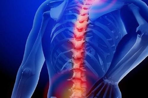 5 lý do gây thoát vị đĩa đệm ai cũng nên biết