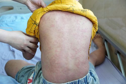 Bé trai đau bụng suốt 3 ngày, bố mẹ bất ngờ khi bác sĩ báo lý do