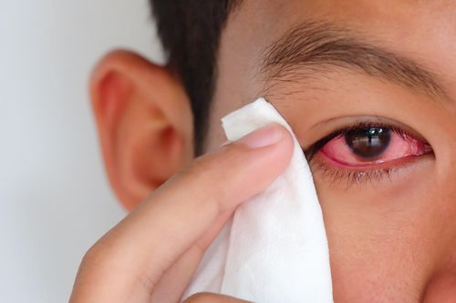 Nhìn vào mắt người bị đau mắt đỏ có lây không?