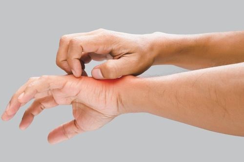 Cách nhận biết bạn đang bị nấm da