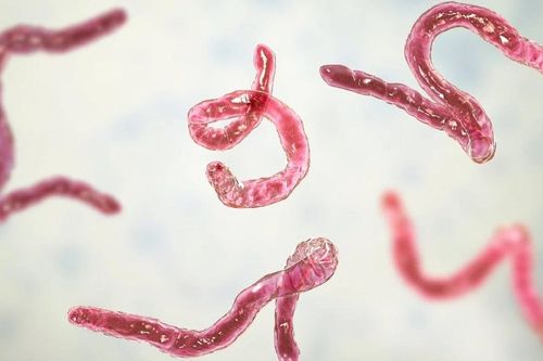 Dấu hiệu điển hình khi bị nhiễm giun đường ruột