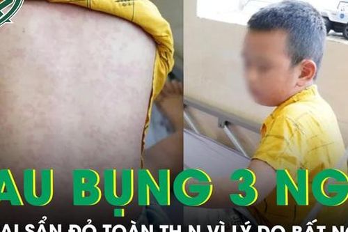 Bé trai 8 tuổi sẩn đỏ toàn thân, đau bụng vùng quanh rốn suốt 3 ngày vì lý do bất ngờ
