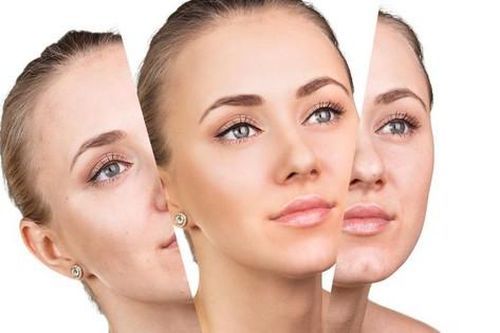 3 dấu hiệu nhận biết da bị lão hóa