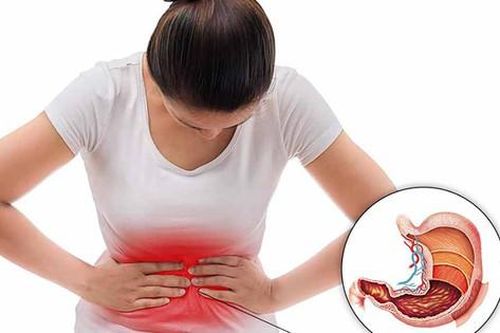 Polyp dạ dày có nguy cơ ung thư không?