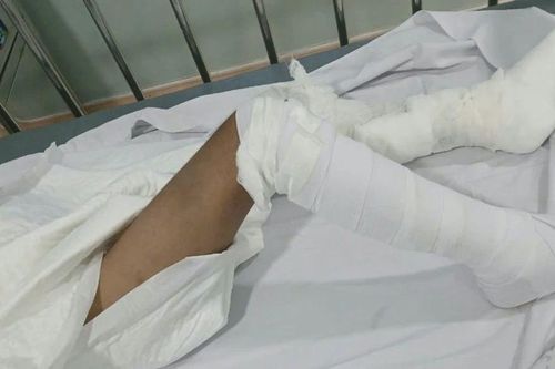Vụ bé trai 6 tuổi nghi bị bạo hành ở quận 8: Công an đang truy tìm 2 người liên quan