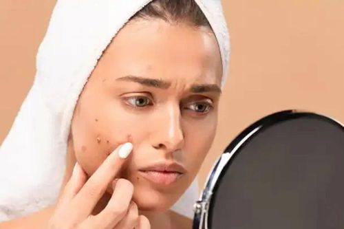 Bật mí 7 cách trị mụn tại nhà đơn giản, dễ thực hiện