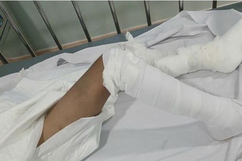Tình trạng bé trai nghi bị bạo hành ở TPHCM ra sao?