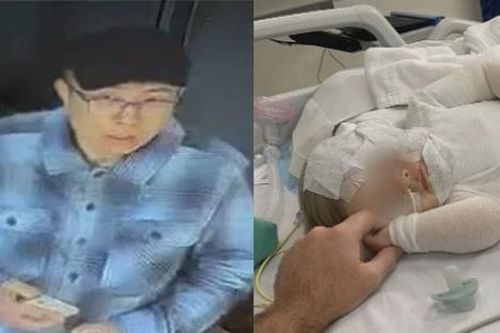 Bị người đàn ông lạ tạt cà phê nóng, bé trai 9 tháng tuổi bị bỏng nặng