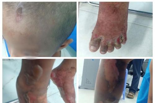 Truy tìm cha của bé trai 6 tuổi nghi bị bạo hành để làm rõ vụ việc