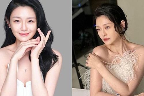 Loại vitamin làm sản sinh collagen, tăng độ đàn hồi, giúp da săn chắc mà Từ Hy Viên hay dùng