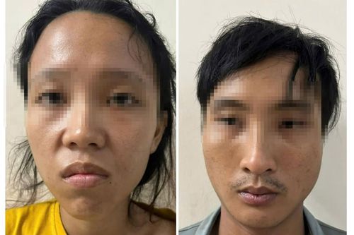 Bé trai 6 tuổi bỏng nặng nghi do bạo hành, cha ruột và mẹ kế bị bắt