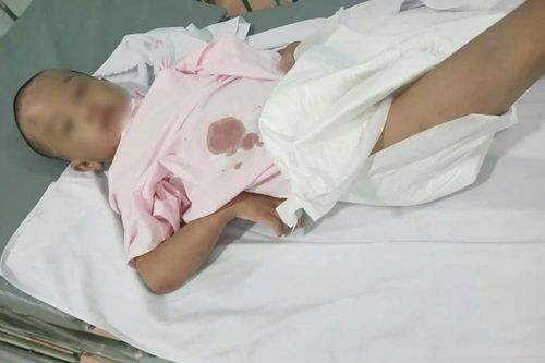 TP Hồ Chí Minh: Khởi tố cha ruột và 'dì ghẻ' nghi bạo hành bé trai 6 tuổi