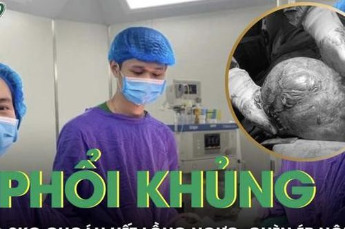 Sút cân nghiêm trọng, người phụ nữ bàng hoàng phát hiện khối u phổi 2kg