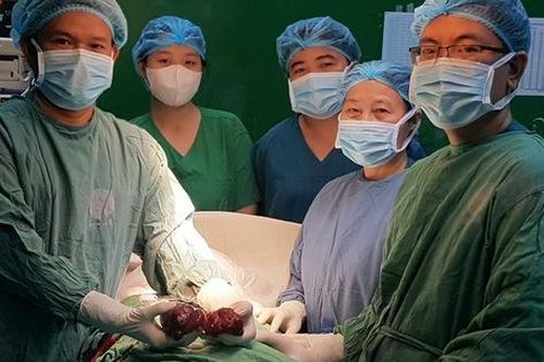 Bệnh nhân basedow 12 năm có khối bướu 'cực khủng' phải vào viện cấp cứu