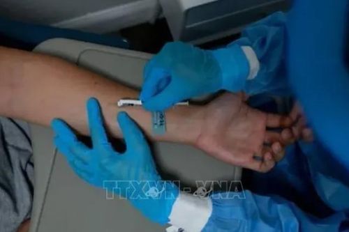 WHO cấp phép chẩn đoán ngoại vi bệnh đậu mùa khỉ