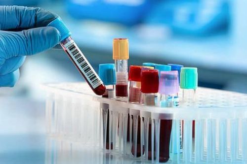 Vai trò của xét nghiệm tế bào CD4 với người nhiễm HIV