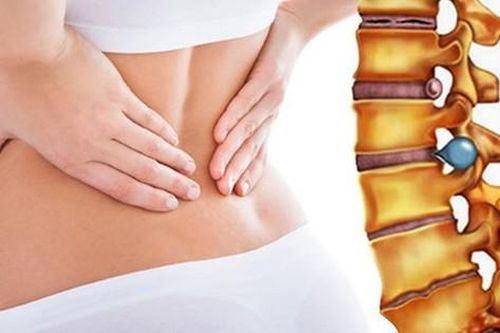 Khi nào cần phẫu thuật thoát vị đĩa đệm?