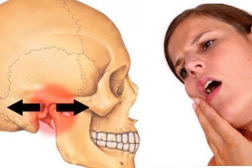 Nguyên nhân gây viêm khớp thái dương hàm